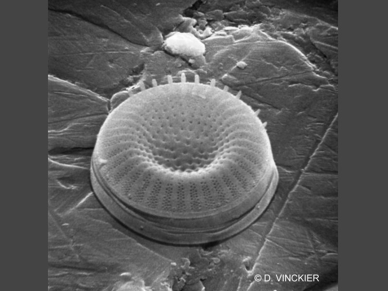 stephanodiscus_sp1dv