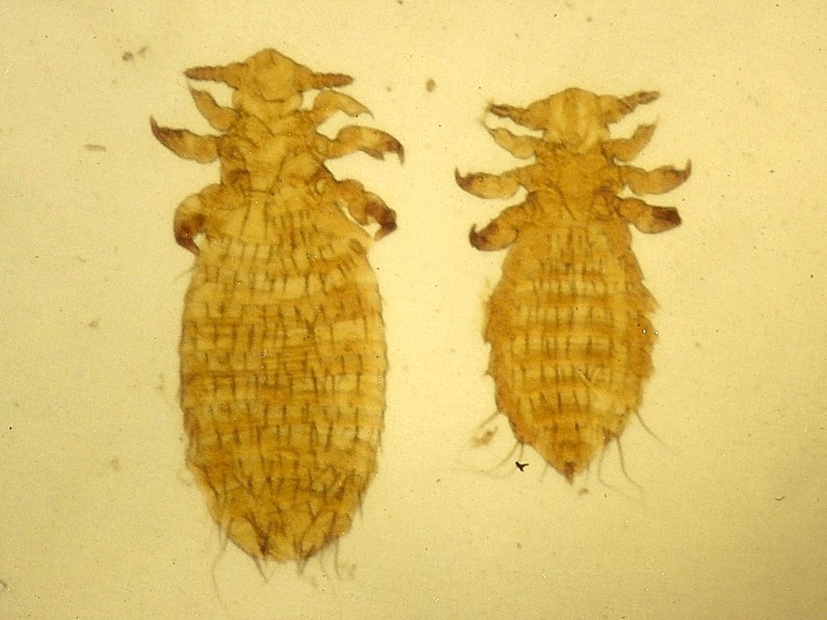 pediculus_capitis2md