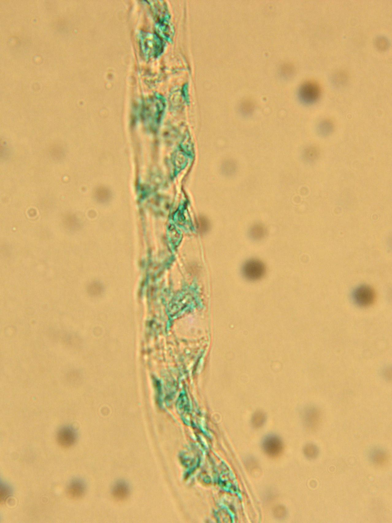 Spirogyra_sp