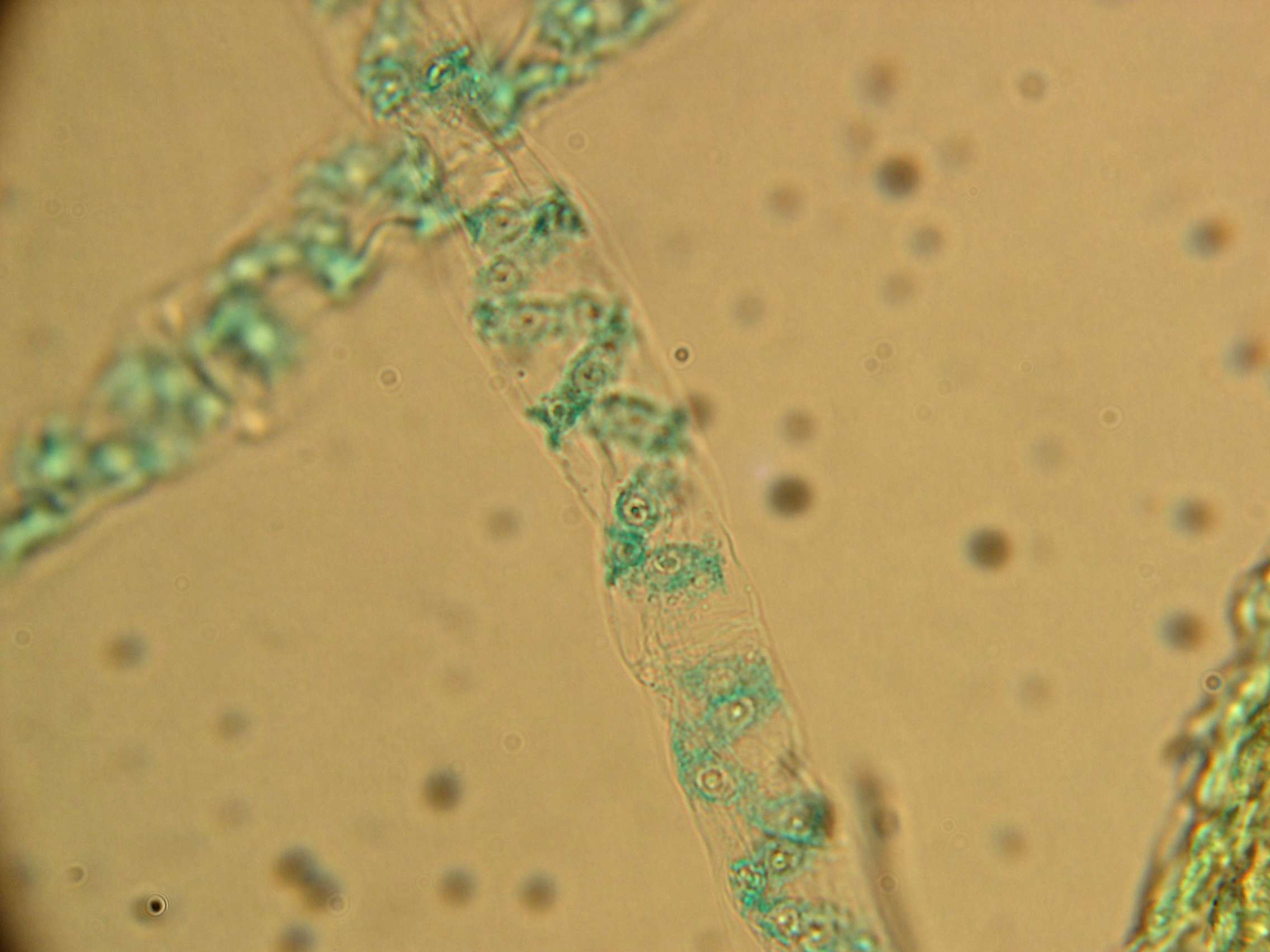 Spirogyra_sp