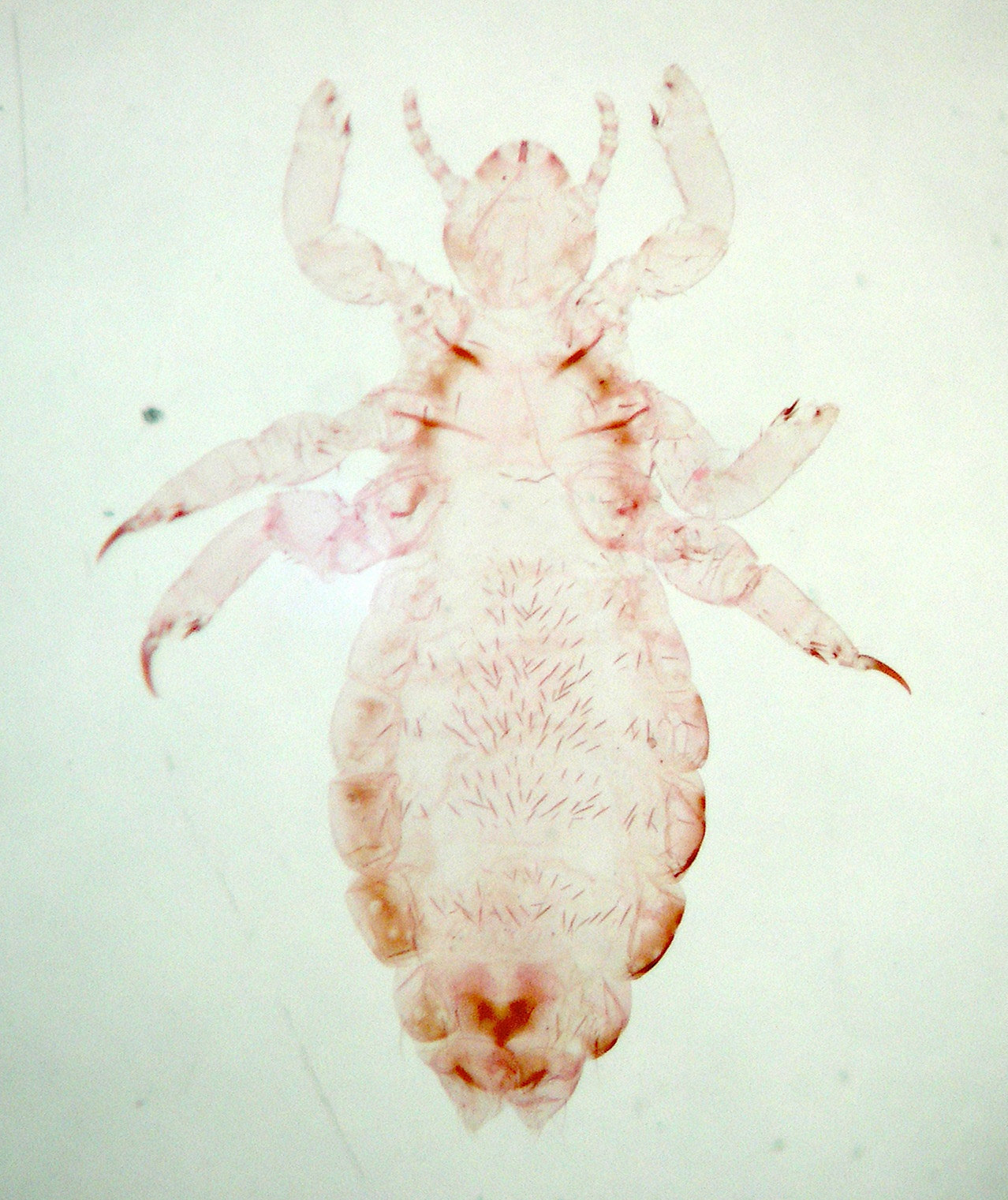 pediculus_capitis4md