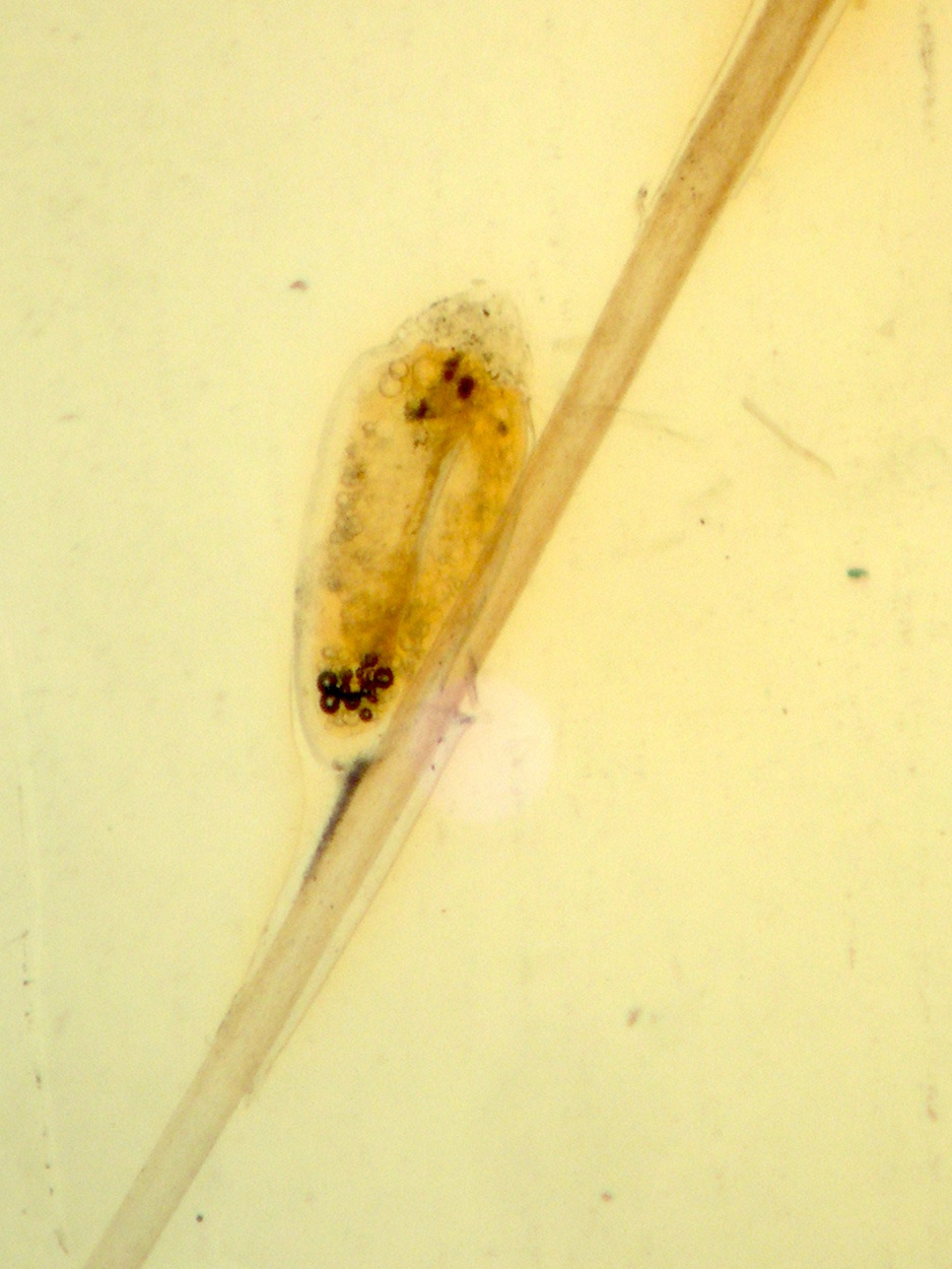 pediculus_capitis5md