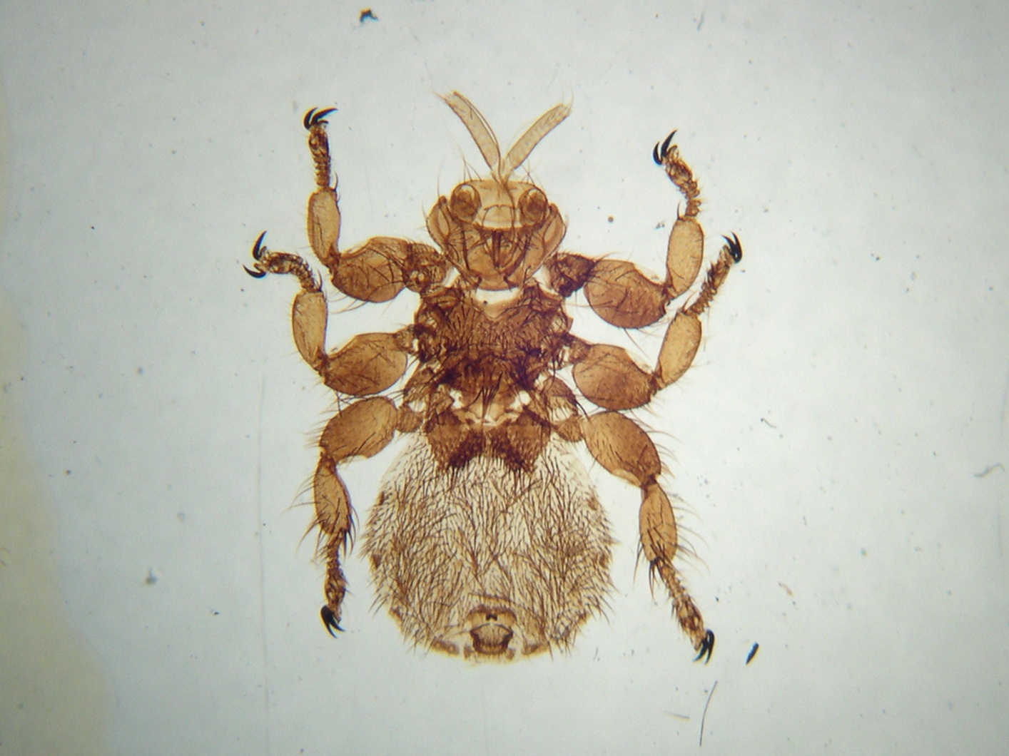 melophagus_ovinus1md