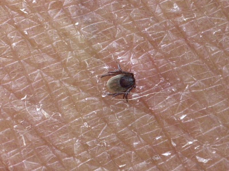 ixodes_ricinus2md