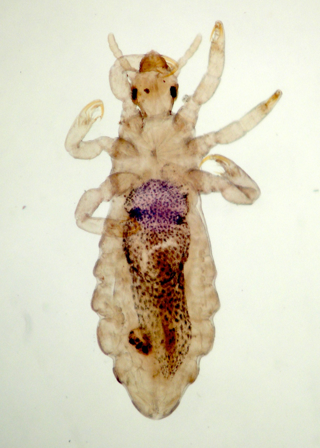 pediculus_capitis3md