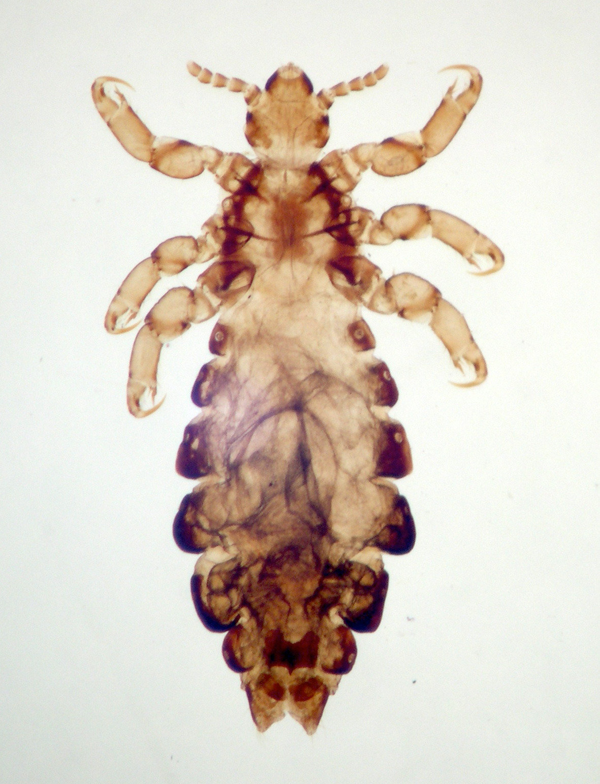 pediculus_capitis1md