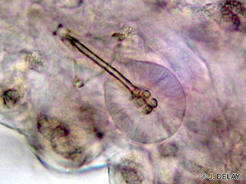macrobiotus_grp_hufelandi3jd