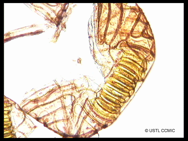polypodium_australe5ccmic