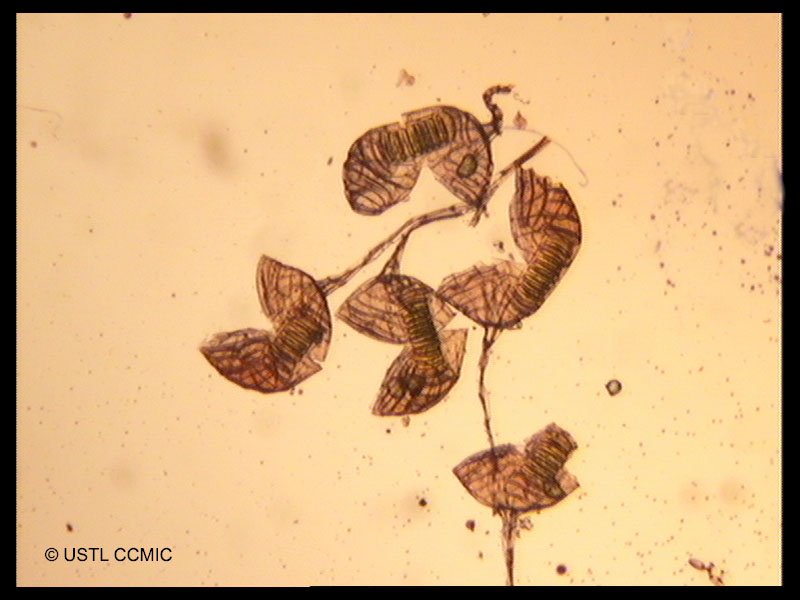 polypodium_australe6ccmic