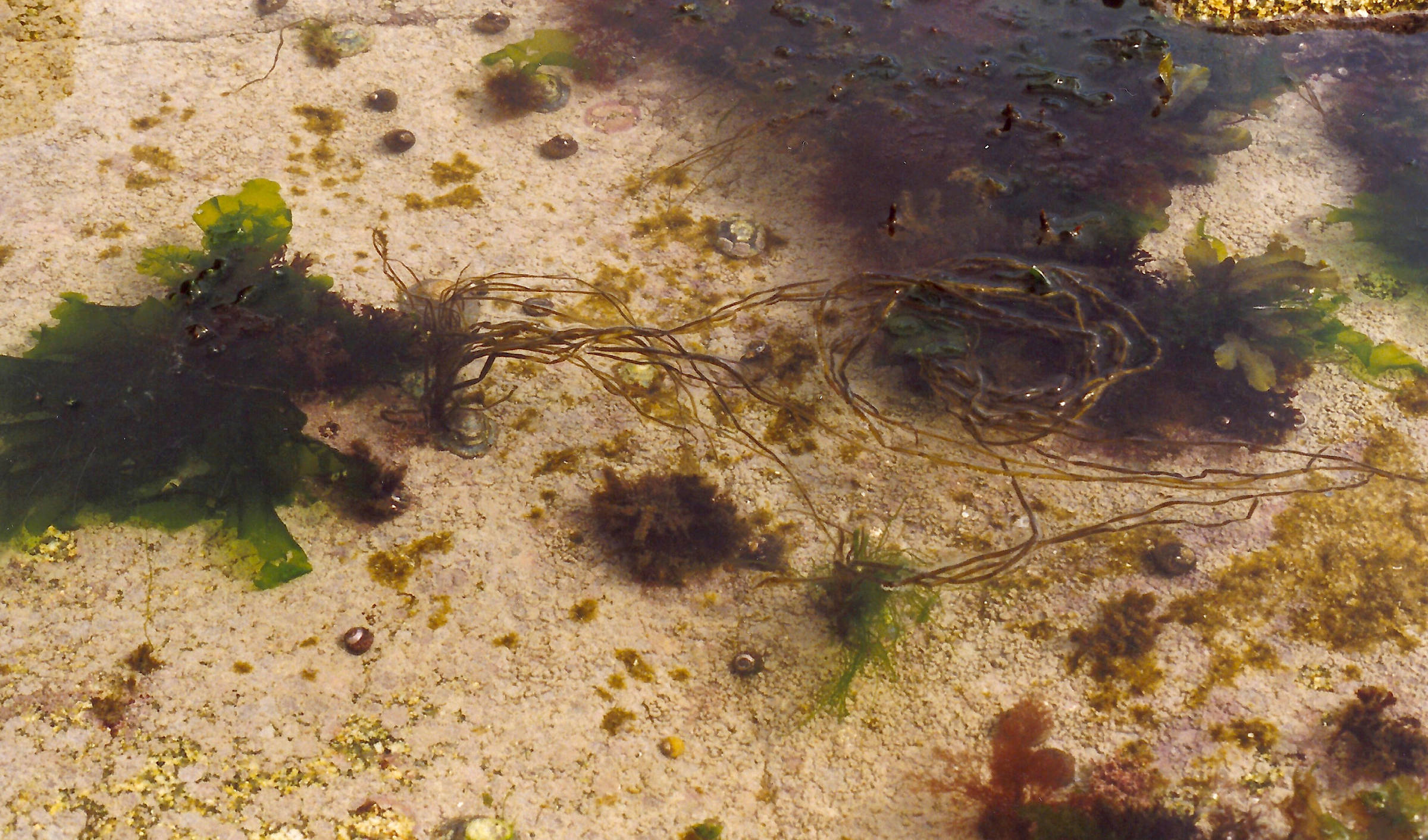 Afficher le média chorda_filum1md chorda_filum1md