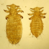 pediculus_capitis2md