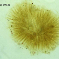 Rivularia bullata (Rivulaire bulleuse)